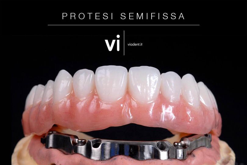 Protesi dentale semifissa - Viadent, Fiume, Croazia