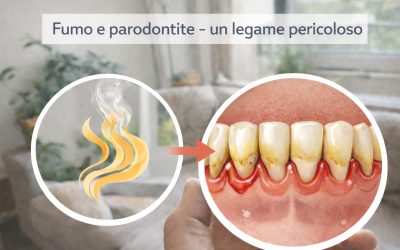 Fumo e parodontite: un rischio serio per la salute delle gengive